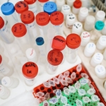 MEB8217den-2026-LGS-Mart-Ayi-Ornek-Sorulari-ve-Cozum-Videolari-Yayimlandi-featured