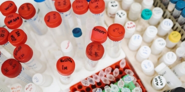 MEB8217den-2026-LGS-Mart-Ayi-Ornek-Sorulari-ve-Cozum-Videolari-Yayimlandi-featured